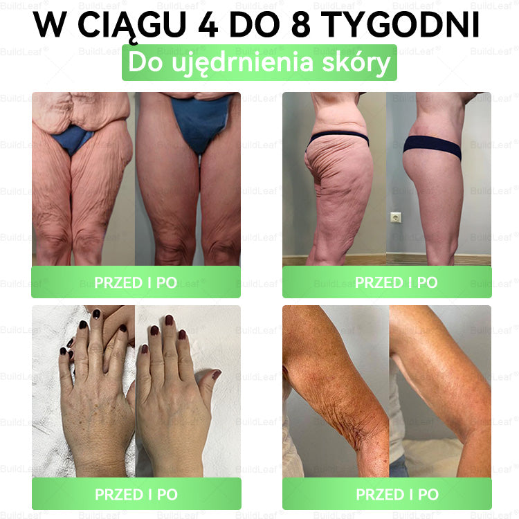 🍃Oficjalny sklep Polska | BuildLeaf® GLP-1 8-w-1 Fit & Vital Rozwiązanie (Jednorazowe dziennie, widoczne zmiany w ciągu 7 dni) ✅ Otyłość, zdrowie sercowo-naczyniowe, cukrzyca, bezdech senny, zdrowie jelit, problemy ze stawami i inne.