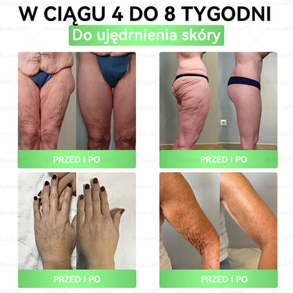 🍃Oficjalny sklep Polska | BuildLeaf® GLP-1 8-w-1 Fit & Vital Rozwiązanie (Jednorazowe dziennie, widoczne zmiany w ciągu 7 dni) ✅ Otyłość, zdrowie sercowo-naczyniowe, cukrzyca, bezdech senny, zdrowie jelit, problemy ze stawami i inne.