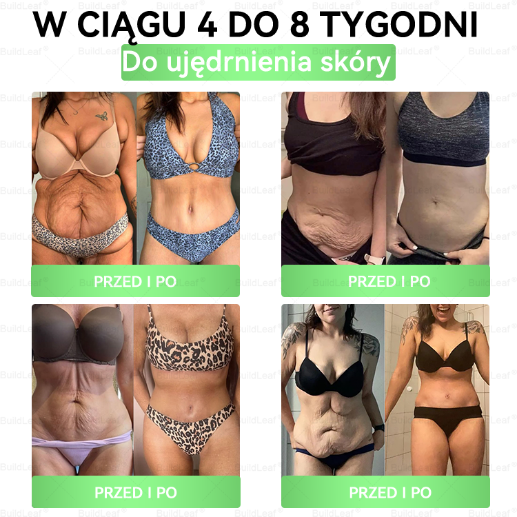 🍃Oficjalny sklep Polska | BuildLeaf® GLP-1 8-w-1 Fit & Vital Rozwiązanie (Jednorazowe dziennie, widoczne zmiany w ciągu 7 dni) ✅ Otyłość, zdrowie sercowo-naczyniowe, cukrzyca, bezdech senny, zdrowie jelit, problemy ze stawami i inne.